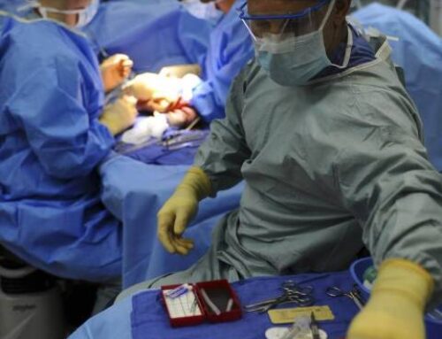 COVID-19 epidemic – a second opinion for considering surgeries